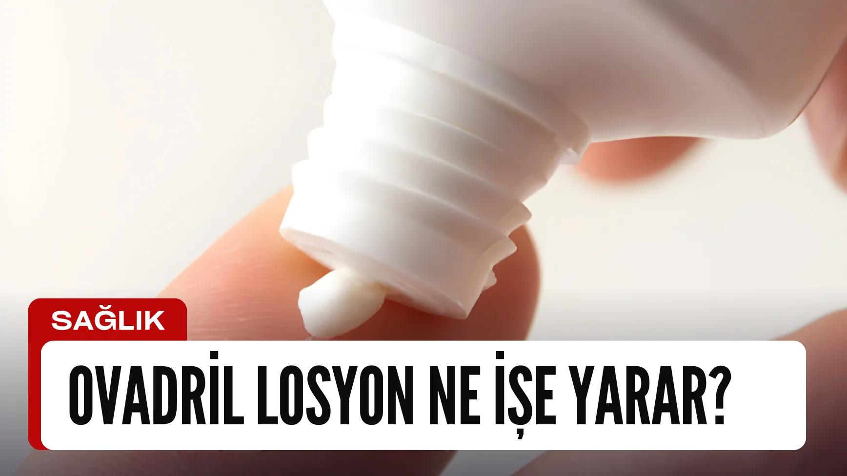 Ovadril Losyon Fiyatı Ne Kadar? Yüze Sürülür Mü?