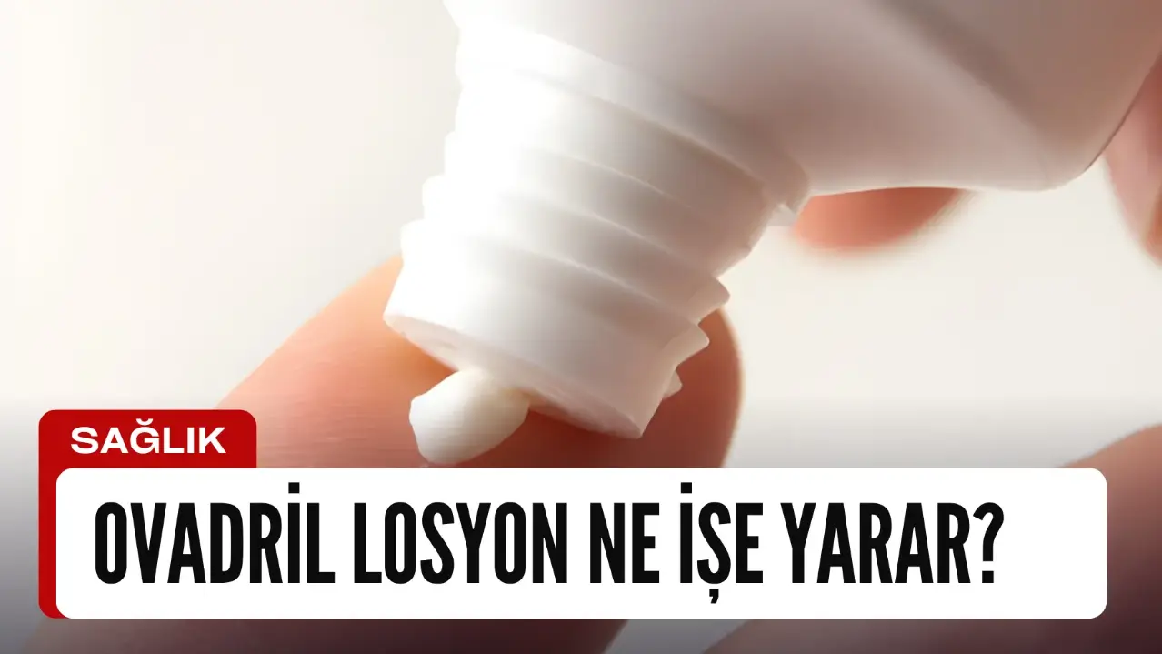Ovadril Losyon Fiyatı Ne Kadar? Yüze Sürülür Mü?